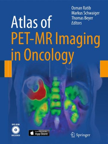 Ultimate Guide to PET Scan Prep for Cancer: Maximize Your Diagnostic Experience