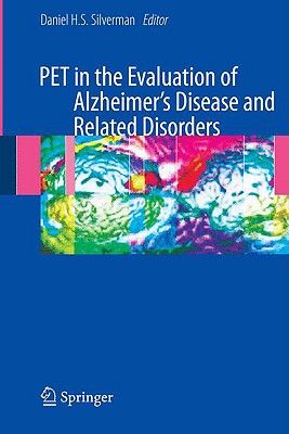  The Revolutionary Role of PET Imaging for Alzheimer's: Unveiling Early Detection and Treatment Strategies