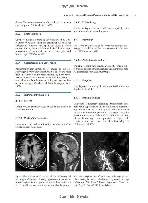  Unlocking the Secrets of Disease Diagnosis with PET and SPECT Imaging: A Comprehensive Guide to Advanced Medical Imaging Techniques