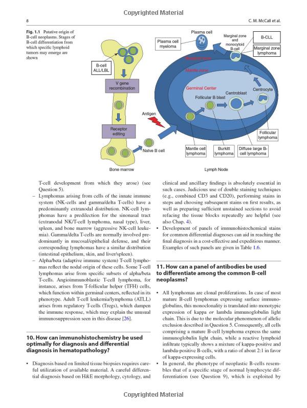  Understanding the Implications of Hypermetabolic Lymph Node on PET Scan: A Comprehensive Guide